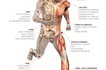 K-laser treatment